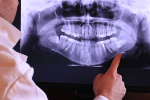 Best Tooth Pain Emergency Relief  in Fall River, MA