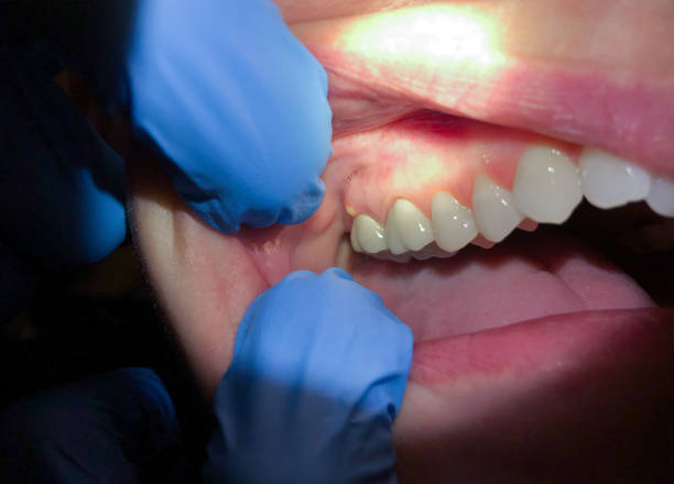 Best Tooth Pain Emergency Relief  in Fall River, MA