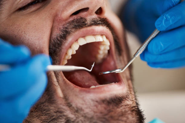 Best Emergency Tooth Extraction  in Fall River, MA