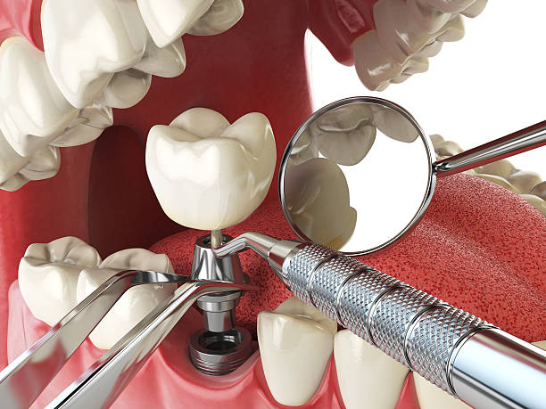 Best Urgent Tooth Repair  in Fall River, MA