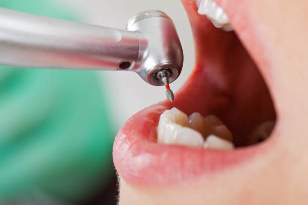 Best Tooth Infection Emergency Dentist  in Fall River, MA